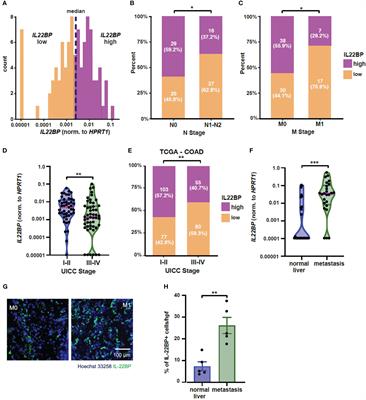 IL-22BP controls the progression of liver metastasis in colorectal cancer